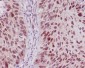 Anti-TRAF6 Rabbit Monoclonal Antibody